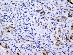 Invitrogen Emerin Monoclonal Antibody (5A10) 100 &mu;g; Unconjugated:Antibodies,