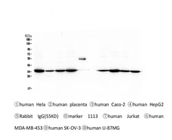 Invitrogen Emerin Monoclonal Antibody (5A10) 100 &mu;g; Unconjugated:Antibodies,
