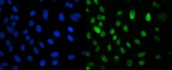 Invitrogen CRM1 Monoclonal Antibody (5G3) 100 &mu;g; Unconjugated:Antibodies,