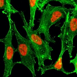 Invitrogen H2BK23ac Recombinant Rabbit Monoclonal Antibody (RM260) 100