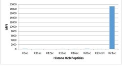 Invitrogen H2BK23ac Recombinant Rabbit Monoclonal Antibody (RM260) 100