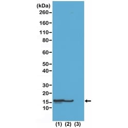 Invitrogen H2BK23ac Recombinant Rabbit Monoclonal Antibody (RM260) 100