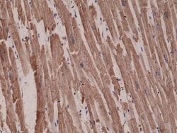 Invitrogen alpha-Cardiac Actin Recombinant Rabbit Monoclonal Antibody (RM257)