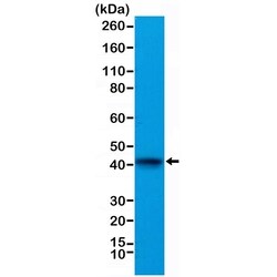 Invitrogen alpha-Cardiac Actin Recombinant Rabbit Monoclonal Antibody (RM257)