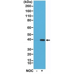 Invitrogen Aurora B Recombinant Rabbit Monoclonal Antibody (RM278) 100