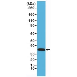 Invitrogen Calponin 1 Recombinant Rabbit Monoclonal Antibody (RM262) 100 &mu;L | Buy Online | Invitrogen&trade; | Fisher Scientific