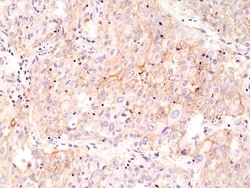 Invitrogen PD-L1 (CD274) Recombinant Rabbit Monoclonal Antibody (RM320)