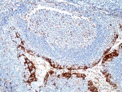 Invitrogen PD-L1 (CD274) Recombinant Rabbit Monoclonal Antibody (RM320)