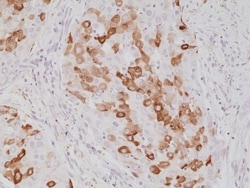 Invitrogen SFTPA1 Recombinant Rabbit Monoclonal Antibody (RM334) 100 &mu;L;