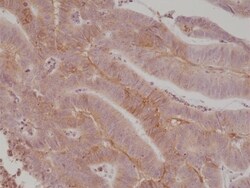 Invitrogen B7-H3 (CD276) Recombinant Rabbit Monoclonal Antibody (RM335)