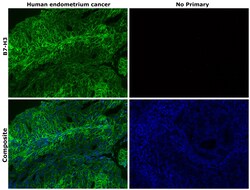Invitrogen B7-H3 (CD276) Recombinant Rabbit Monoclonal Antibody (RM335)