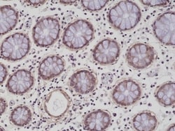 Invitrogen Integrin beta 1 (CD29) Recombinant Rabbit Monoclonal Antibody