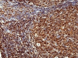 Invitrogen CD45 Recombinant Rabbit Monoclonal Antibody (RM291) 100 &mu;L;