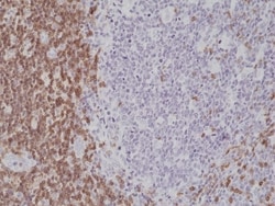 Invitrogen CD5 Recombinant Rabbit Monoclonal Antibody (RM314) 100 &mu;L;