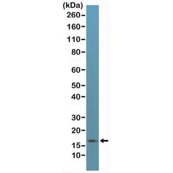 Invitrogen p16INK4a Recombinant Rabbit Monoclonal Antibody (RM267) 100 &mu;L | Buy Online | Invitrogen&trade; | Fisher Scientific