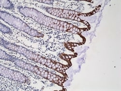 Invitrogen Cytokeratin 20 Recombinant Rabbit Monoclonal Antibody (RM283)