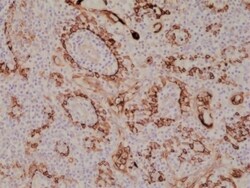 Invitrogen Cytokeratin 17 Recombinant Rabbit Monoclonal Antibody (RM351)