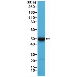 Invitrogen Cytokeratin 17 Recombinant Rabbit Monoclonal Antibody (RM351)