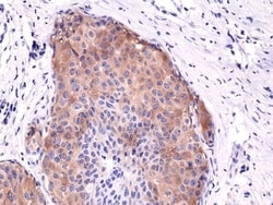 Invitrogen Phospho-Acetyl-CoA Carboxylase (Ser79) Recombinant Rabbit Monoclonal