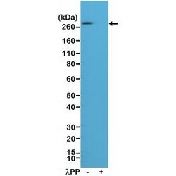 Invitrogen Phospho-Acetyl-CoA Carboxylase (Ser79) Recombinant Rabbit Monoclonal