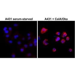 Invitrogen Phosphothreonine Recombinant Rabbit Monoclonal Antibody (RM102)
