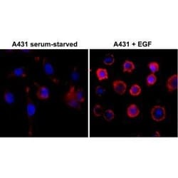 Invitrogen Phosphotyrosine Recombinant Rabbit Monoclonal Antibody (RM111)