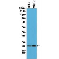 Invitrogen DIABLO Recombinant Rabbit Monoclonal Antibody (RM271) 100 &mu;L | Buy Online | Invitrogen&trade; | Fisher Scientific