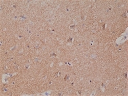 Invitrogen Spastin Recombinant Rabbit Monoclonal Antibody (RM346) 100 &mu;L | Buy Online | Invitrogen&trade; | Fisher Scientific