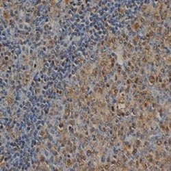 Invitrogen Ubiquitin Monoclonal Antibody (1B4-UB) 100 &mu;g; Unconjugated:Antibodies,