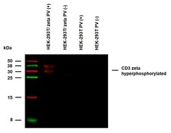 Invitrogen Phospho-CD247 (CD3 zeta) (Tyr72) Monoclonal Antibody (EM-26) 100 &mu;g | Buy Online | Invitrogen&trade; | Fisher Scientific