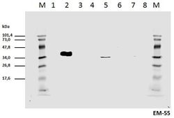 Invitrogen Phospho-CD247 (CD3 zeta) (Tyr111, Tyr123) Monoclonal Antibody