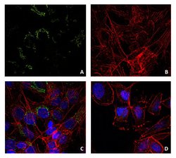 Invitrogen Lysozyme Monoclonal Antibody (LZ598-10G9) 100 &mu;g; Unconjugated:Antibodies,