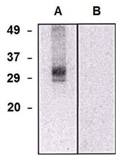Invitrogen CLIC5 Monoclonal Antibody (CLIC5-02) 100 &mu;g; Unconjugated:Antibodies,