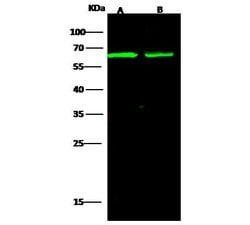 Invitrogen CD166 Recombinant Rabbit Monoclonal Antibody (008) 100 &mu;L | Buy Online | Invitrogen&trade; | Fisher Scientific