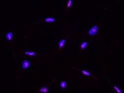 Invitrogen ABHEB Recombinant Rabbit Monoclonal Antibody (002) 100 &mu;L;