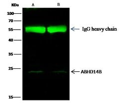 Invitrogen ABHEB Recombinant Rabbit Monoclonal Antibody (011) 100 &mu;L | Buy Online | Invitrogen&trade; | Fisher Scientific