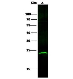 Invitrogen ABHEB Recombinant Rabbit Monoclonal Antibody (011) 100 &mu;L | Buy Online | Invitrogen&trade; | Fisher Scientific