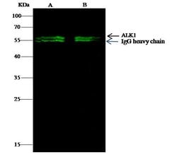 Invitrogen ACVRL1 Recombinant Rabbit Monoclonal Antibody (124) 100 &mu;L;