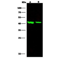 Invitrogen ACVRL1 Recombinant Rabbit Monoclonal Antibody (124) 100 &mu;L;