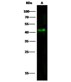 Invitrogen Aminoacylase Monoclonal Antibody (7A11C6C2) 100 &mu;L; Unconjugated:Antibodies,