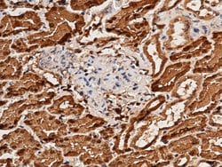 Invitrogen Aminoacylase Recombinant Rabbit Monoclonal Antibody (128) 100