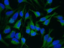 Invitrogen ADAM15 Recombinant Rabbit Monoclonal Antibody (007) 100 &mu;L;