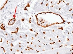Invitrogen ADAM15 Recombinant Rabbit Monoclonal Antibody (007) 100 &mu;L;