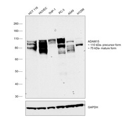 Invitrogen ADAM15 Recombinant Rabbit Monoclonal Antibody (007) 100 &mu;L;