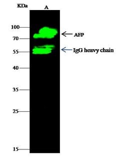 AFP Recombinant Rabbit Monoclonal Antibody (003):Antibodies, Recombinant