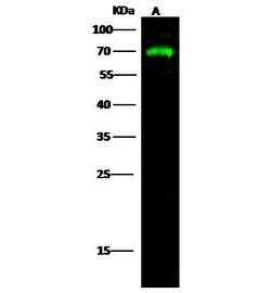 AFP Recombinant Rabbit Monoclonal Antibody (003):Antibodies, Recombinant