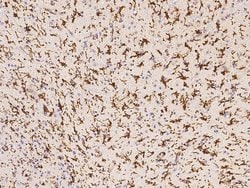 Invitrogen IBA1 Recombinant Rabbit Monoclonal Antibody (031) 100 &mu;L;