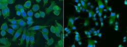 Invitrogen ALDH1A1 Monoclonal Antibody (5G9E6C9) 100 &mu;L; Unconjugated:Antibodies,