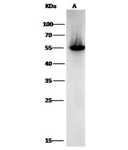 Invitrogen ALDH1A1 Monoclonal Antibody (5G9E6C9) 100 &mu;L; Unconjugated:Antibodies,