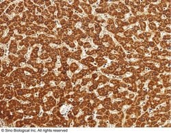Invitrogen ALDH7A1 Monoclonal Antibody (11) 100 &mu;L; Unconjugated:Antibodies,
